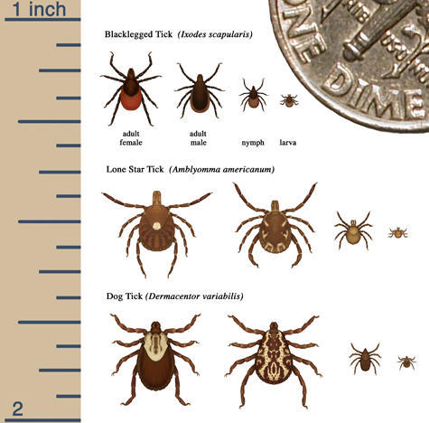 tick removal sizes